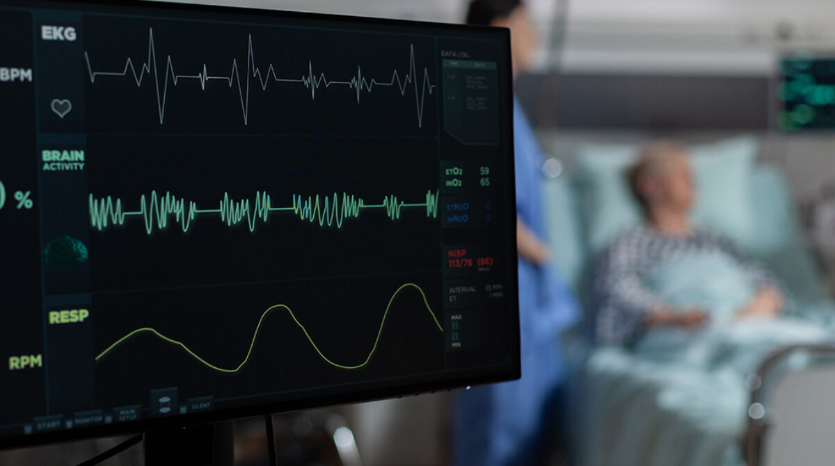 How Risk Factor Modification can help with Atrial Fibrillation