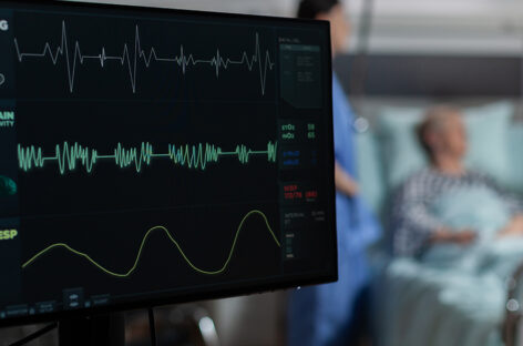 How Risk Factor Modification can help with Atrial Fibrillation