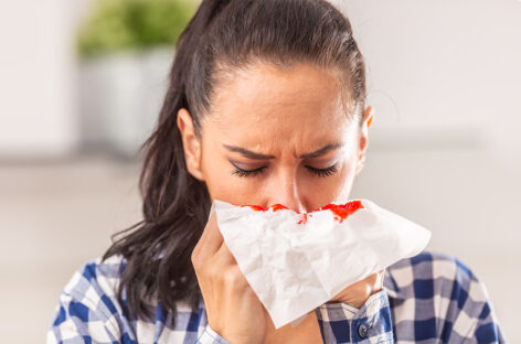 Nosebleeds in Summer – First Aid and Treatment