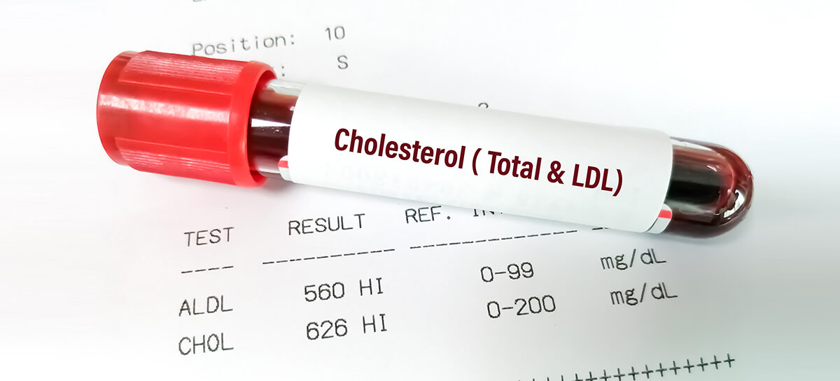 Wake Up – Cholesterol Guidelines Are Evolving. Here’s What You Need to Know