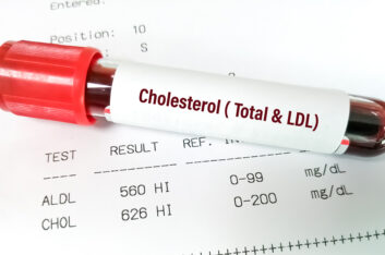 Wake Up – Cholesterol Guidelines Are Evolving. Here’s What You Need to Know