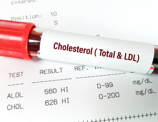 Wake Up – Cholesterol Guidelines Are Evolving. Here’s What You Need to Know
