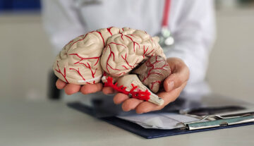 Types of Neurointerventional Procedures