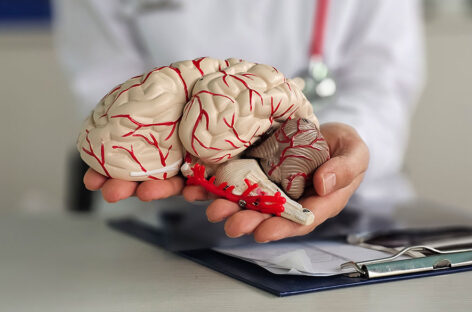 Types of Neurointerventional Procedures
