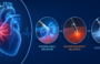Pulsed-field vs. Radiofrequency vs. Cryoablation – Comparing Efficacy in Treating AFib