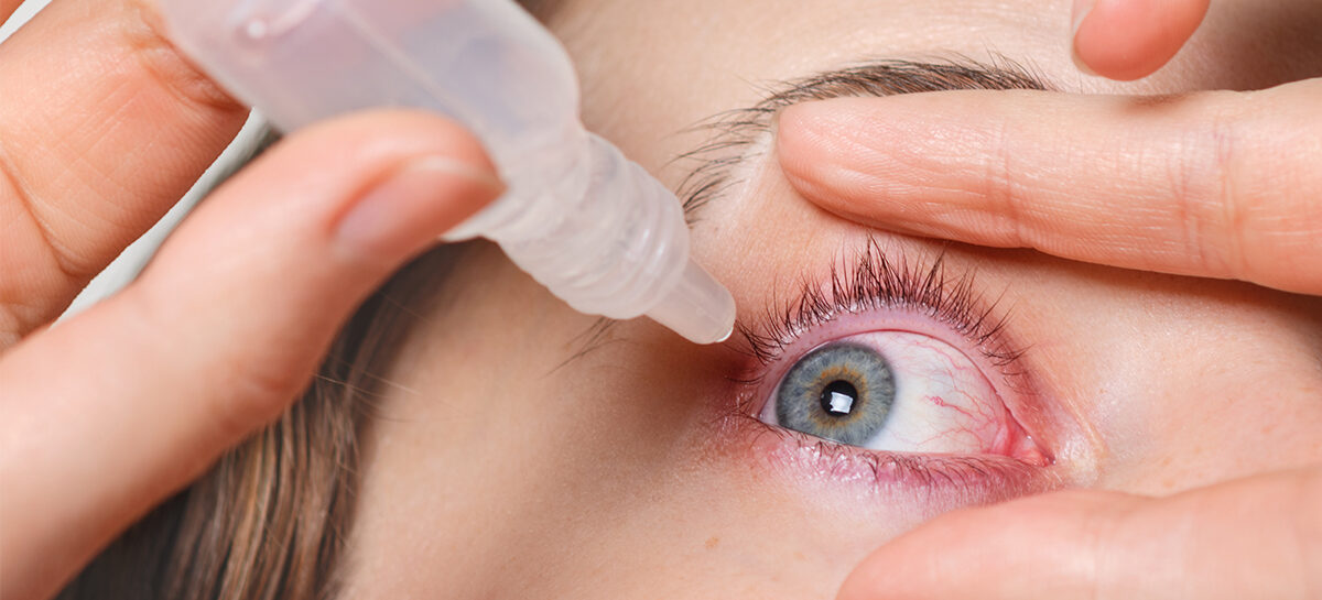 Dry Eyes – Causes and Treatment