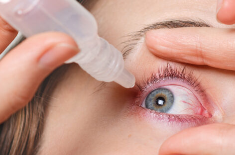Dry Eyes – Causes and Treatment