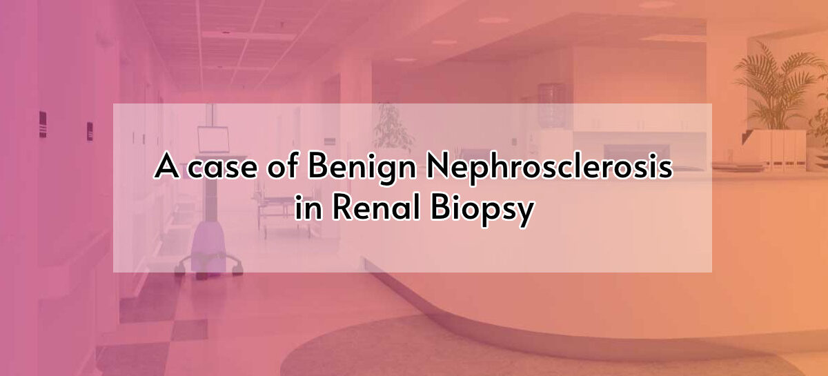 A Case of Benign Nephrosclerosis in Renal Biopsy