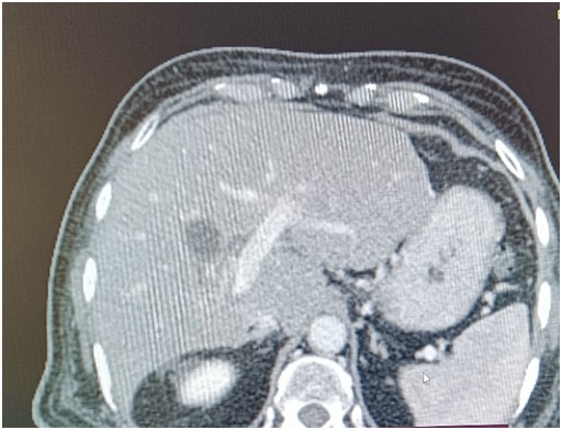 Figure 4-A
