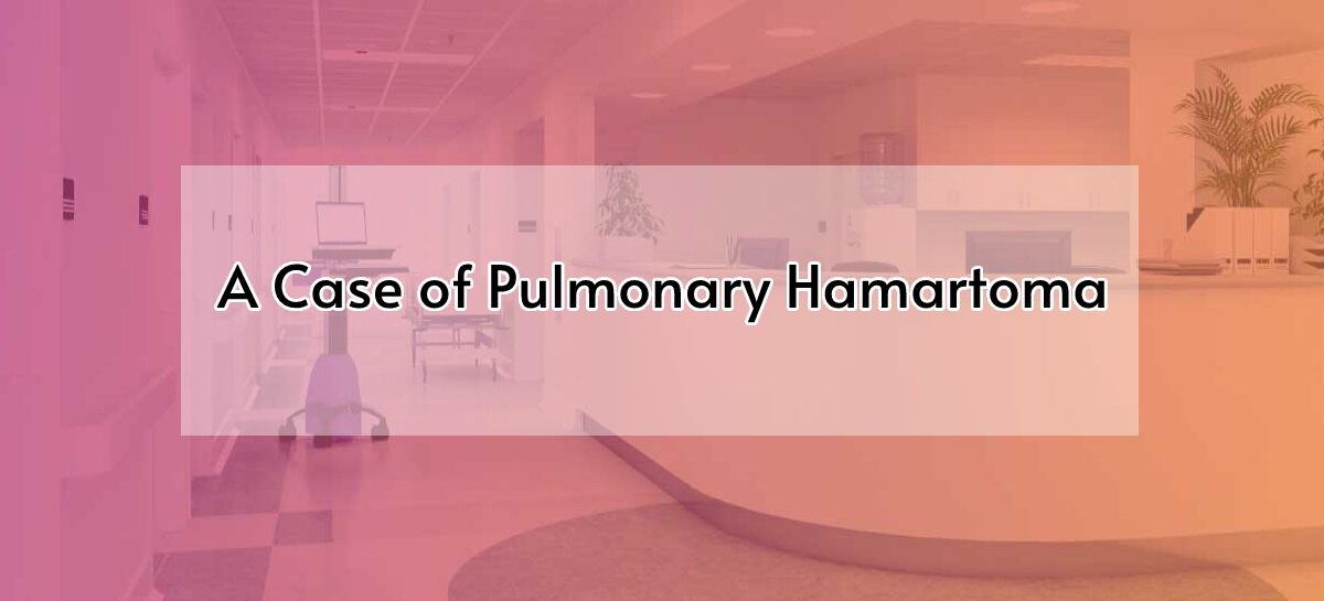 A Case of Pulmonary Hamartoma