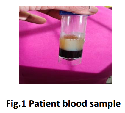 Acute pancreatitis in ICU with a rare cause