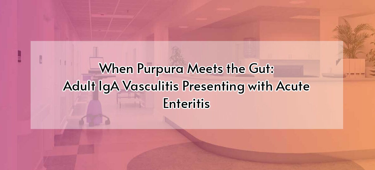 When Purpura Meets the Gut: Adult IgA Vasculitis Presenting with Acute Enteritis