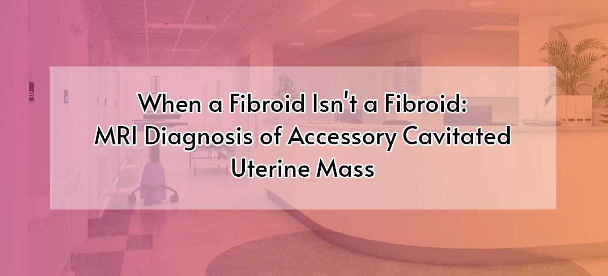 When a Fibroid Isn’t a Fibroid: MRI Diagnosis of Accessory Cavitated Uterine Mass