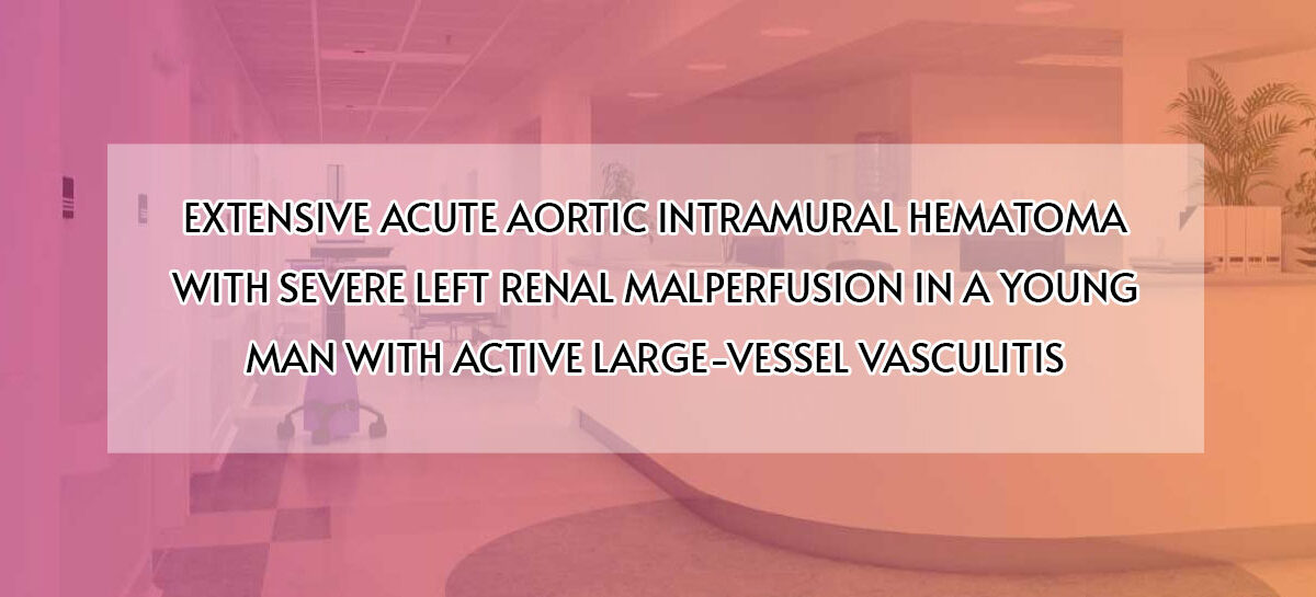 EXTENSIVE ACUTE AORTIC INTRAMURAL HEMATOMA WITH SEVERE LEFT RENAL MALPERFUSION IN A YOUNG MAN WITH ACTIVE LARGE-VESSEL VASCULITIS