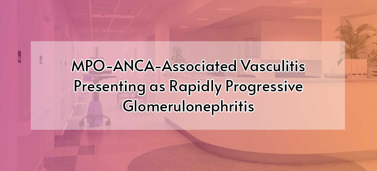 MPO-ANCA–Associated Vasculitis Presenting as Rapidly Progressive Glomerulonephritis
