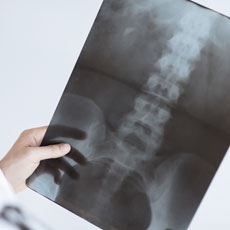 Spine Surgery