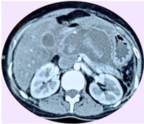 DIAGNOSTIC-IMAGES