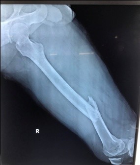 Pre-op x-rays