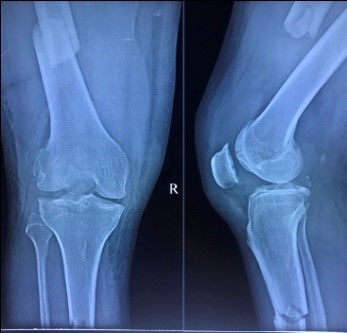 Post-op x-rays