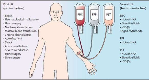 Transfusion-related acute lung injury
