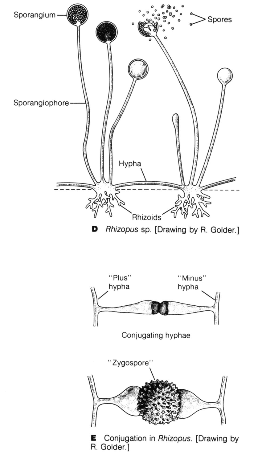 Mucormycosis-2