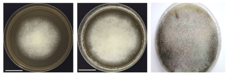 Mucormycosis-3