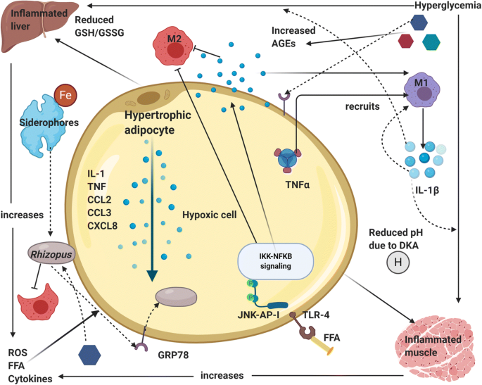Mucormycosis-4