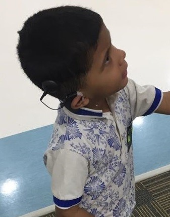 Child wearing the external processor
