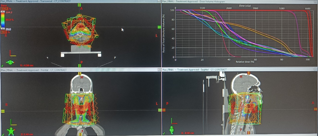 4D