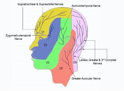 Awake-Craniotomy-2