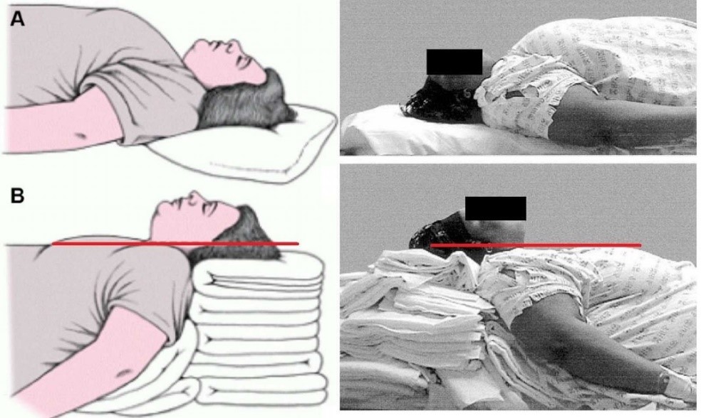 anaesthesia-and-morbid-obesity-1