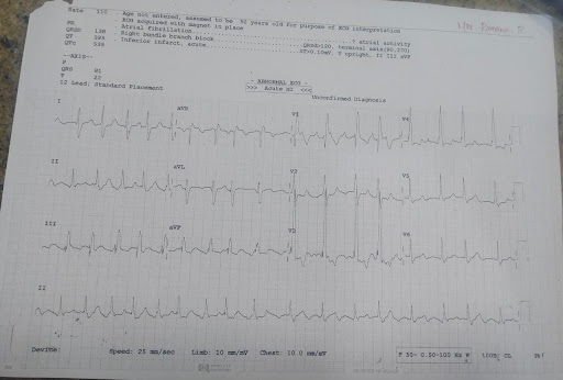 Atrial-flutter