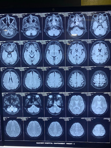 Rhino-Orbital-Cerebro-3