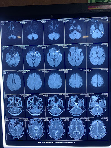 Rhino-Orbital-Cerebro-7