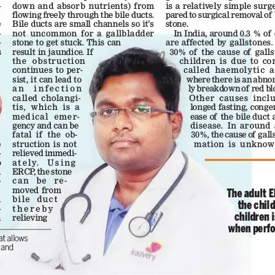 Doctors Speaks: UnderStanding and breaking myths about ERCP - The New Indian Express News