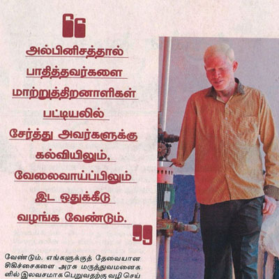 Story on albinism - Kungumam News