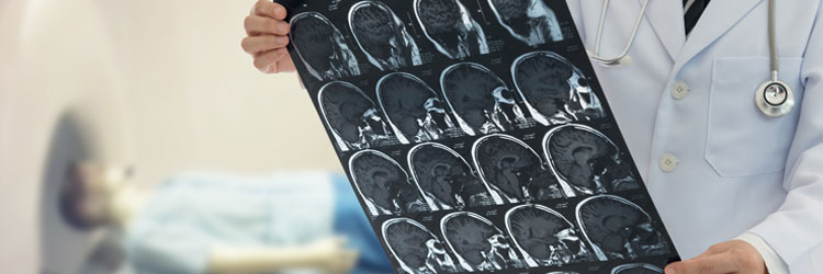 Neurology Problems and Treatment