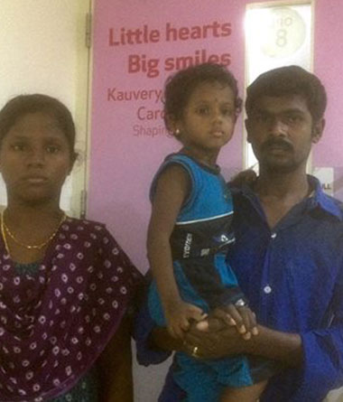 Successful Heart Surgery for 3 year old