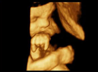 4D Ultrasound - Now available at Kauvery!