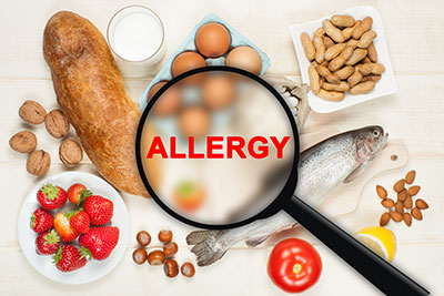  Food allergies