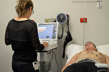 What is the Stress Echocardiogram?