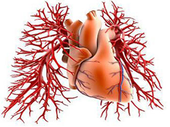 vascular_disease