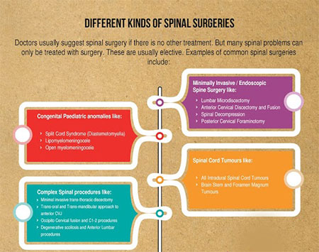 Treatment for spinal problems in Chennai, Trichy, Hosur, Salem, Tirunelveli| Kauvery Hospital