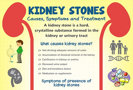 Treatment for kidney stones in Chennai, Trichy, Hosur, Salem, Tirunelveli| Kauvery Hospital
