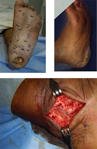 Reconstructive surgery in Chennai, Trichy, Salem,Tirunelveli, India