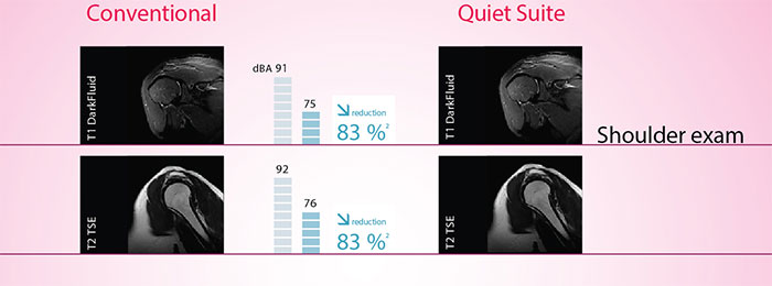 quiet-suite-mri-1