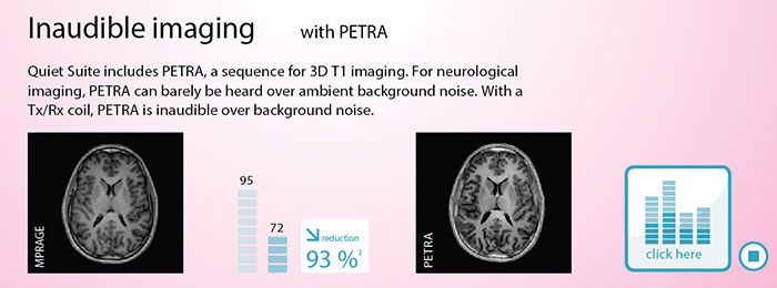 quiet-suite-mri-2