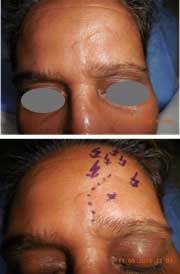 Plastic Surgery Face