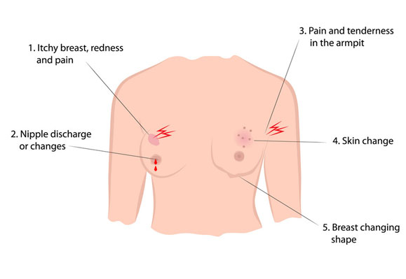 ealy-detection-saves-life-2