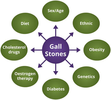 gallstones